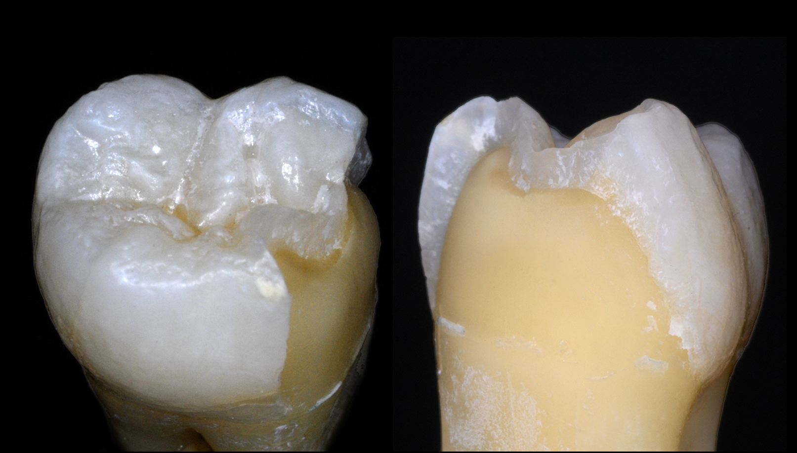 Molar