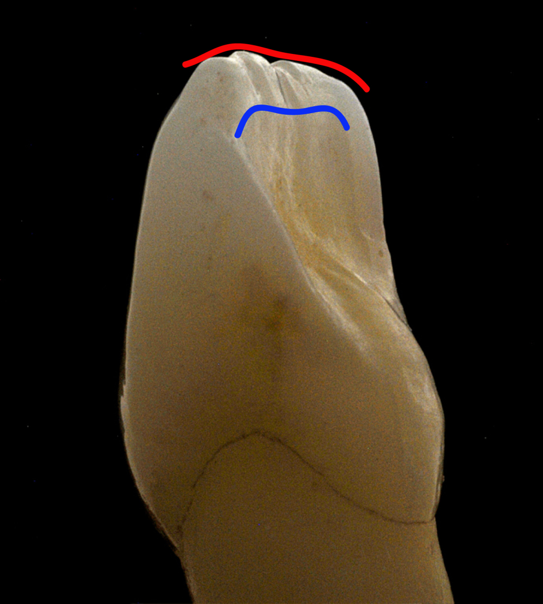 Incisal edge