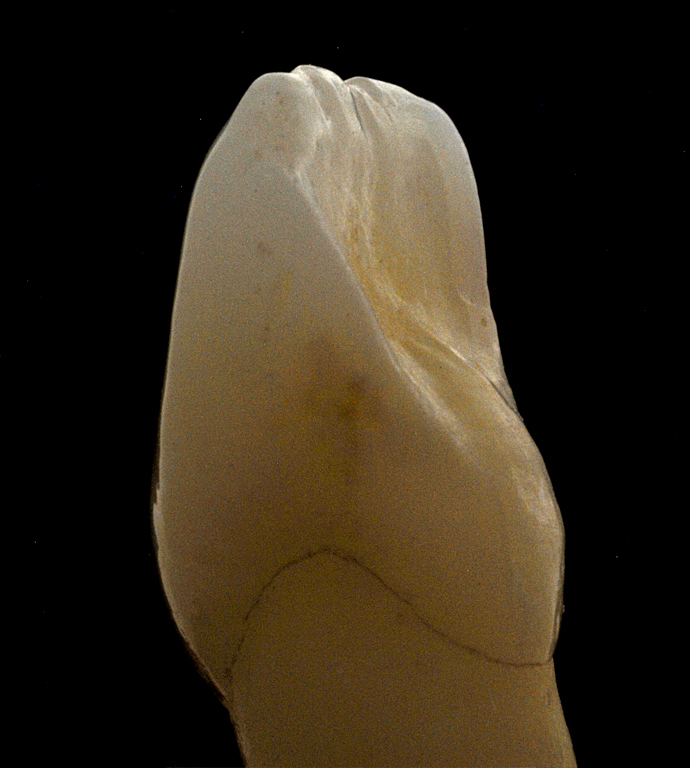 Incisal edge