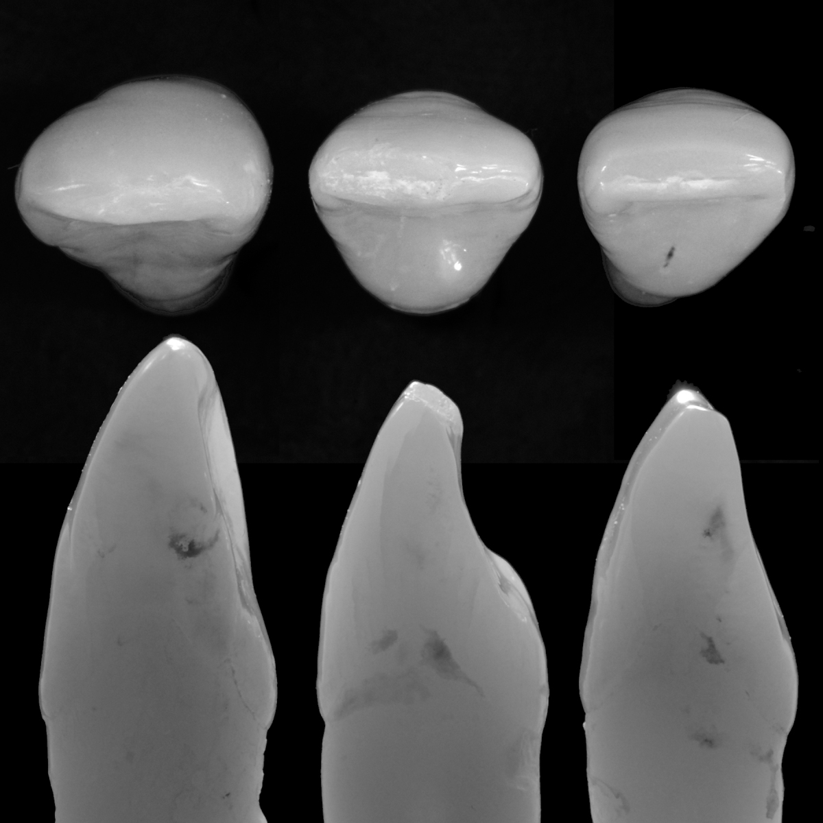 Laterals